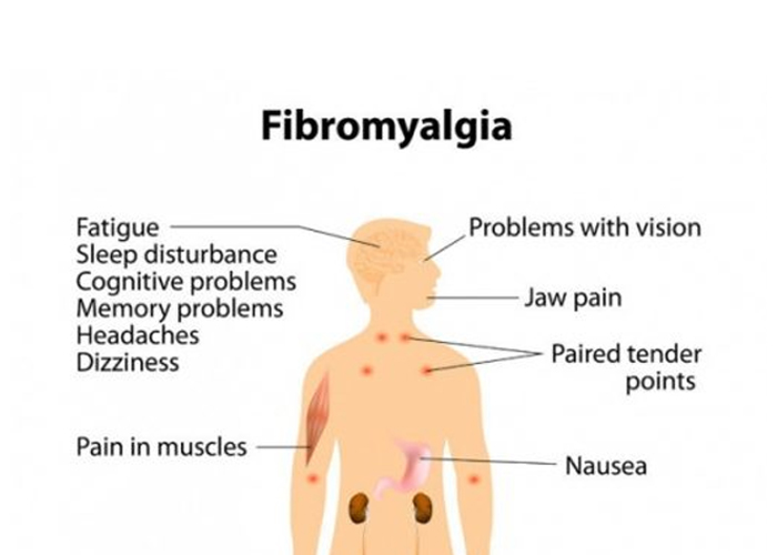 Massage Therapy For Fibromyalgia