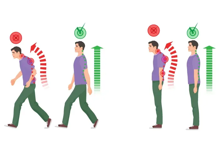 johnstown-colorado-chiropractic-care-importance-of-good-posture Illustration comparing slouched, painful posture with a straight, healthy spine