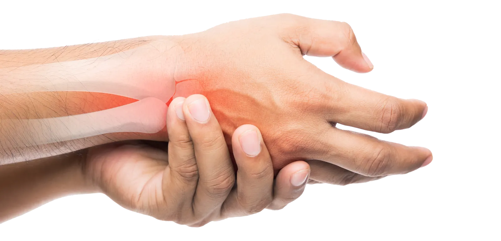 Arthritis of the Joints